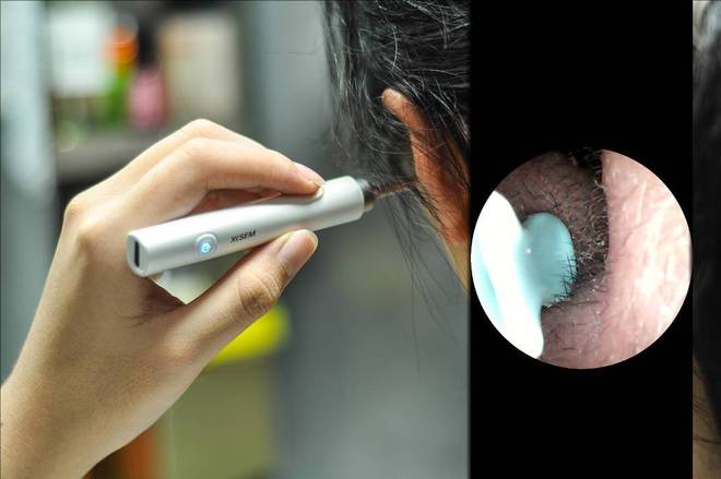 ？挖耳勺到底怎么选？十大品牌测评分享！pg模拟器电脑版带摄像头的挖耳勺好用吗(图11)